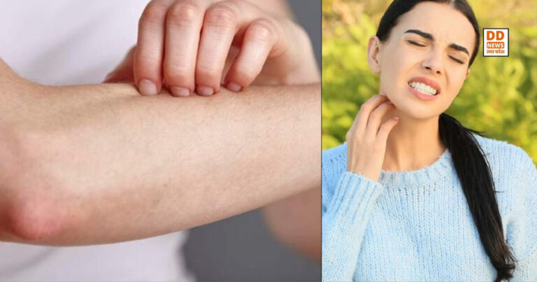 Vitamin Cause Of Itching: कौन से विटामिन की कमी है खुजली की वजह?