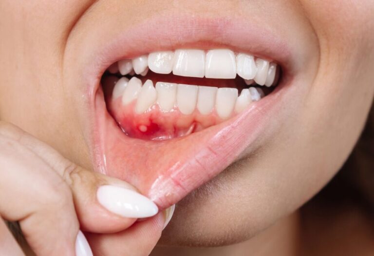 Mouth Cancer Awareness : बार-बार मुंह में हो रहे हैं छाले या बदल रही है आवाज? कहीं ये ओरल कैंसर के शुरुआती संकेत तो नहीं