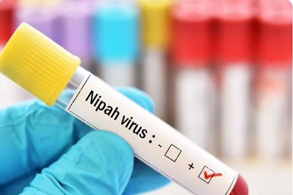 Nipah virus, Kerlam